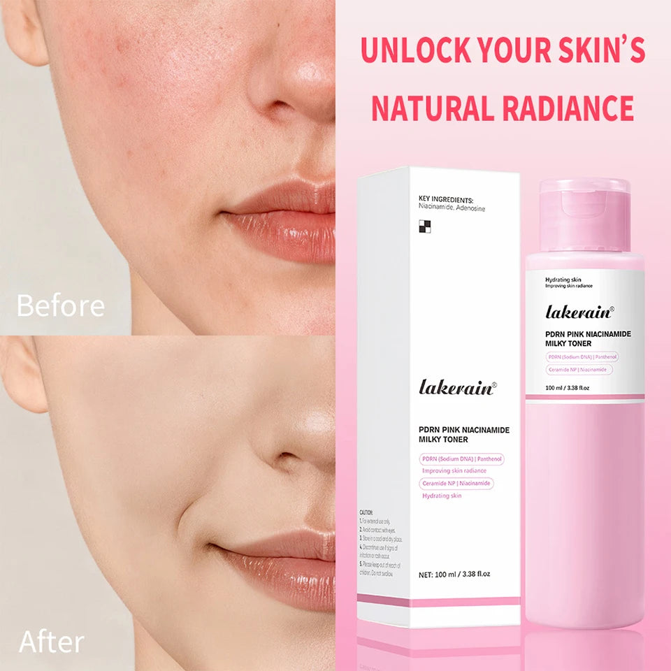 PDRN Pink Niacinamide Milky Toner Hydrating Facial Lotion
