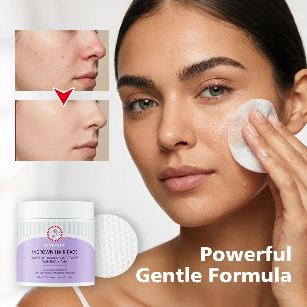Ingrown Hair Treatment Pads Exfoliating Razor Bumps Aftershave Care - 10