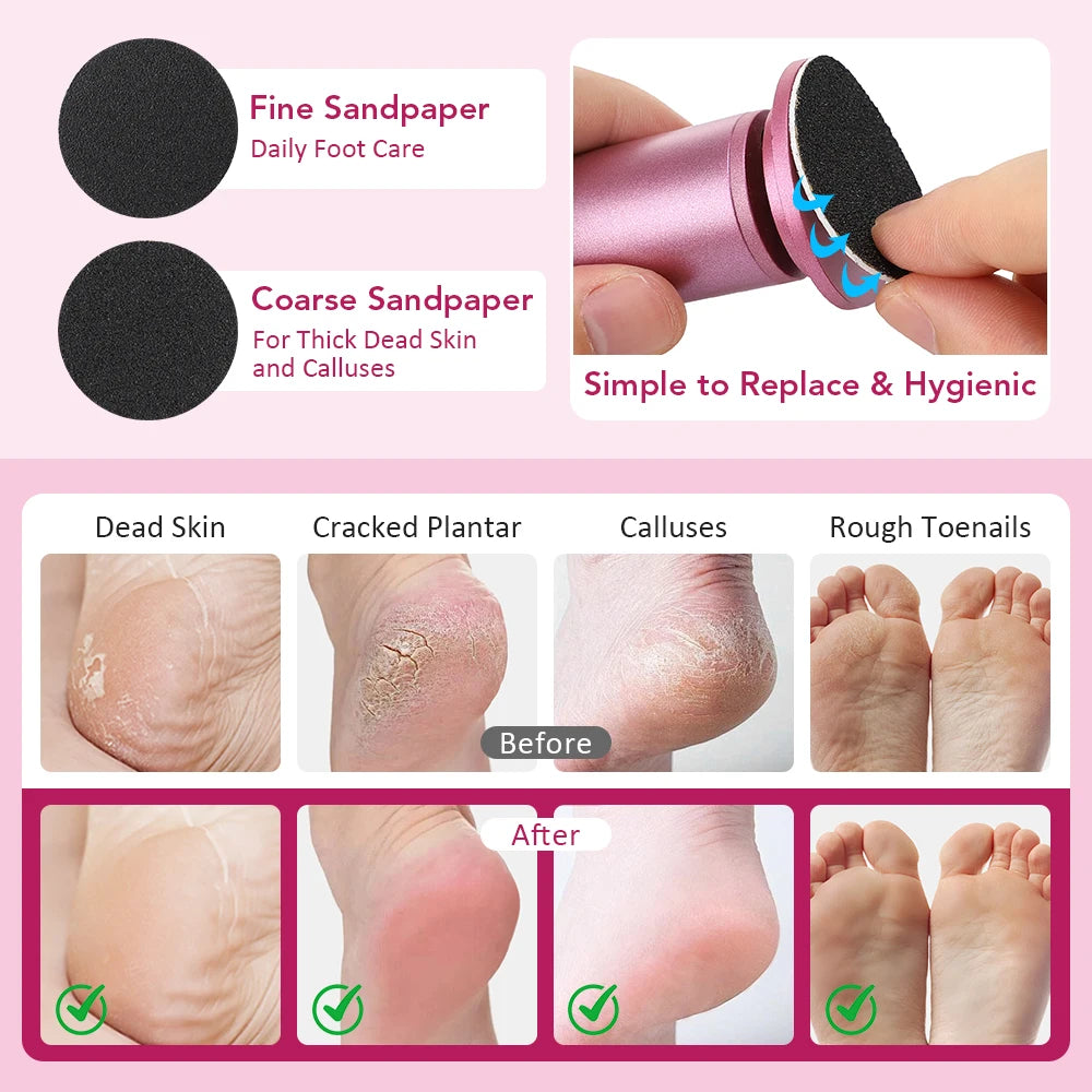 Electric Callus Remover USB Foot File Pedicure Tool - 10