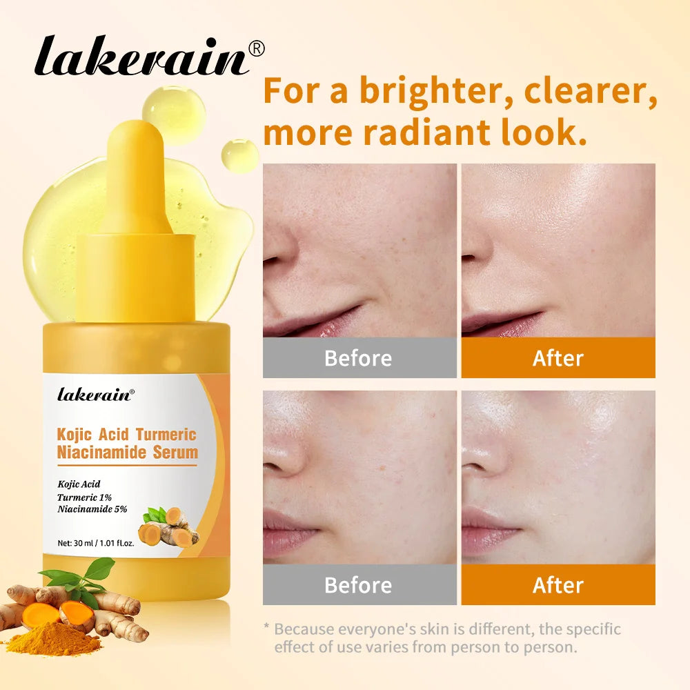 Lakerain Kojic Acid Turmeric Niacinamide Face Serum Brightening Oil - 4
