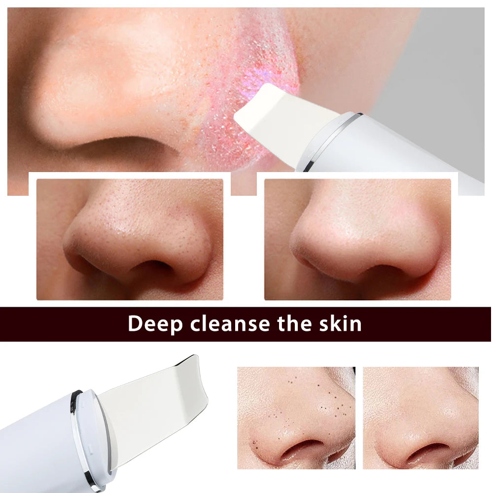Ultrasonic Skin Scrubber Facial Pore Cleaner and Lifting Machine