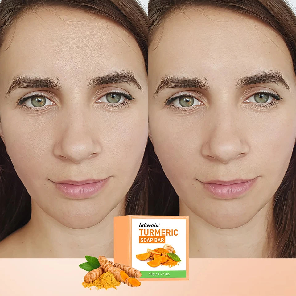 Turmeric Lemon Kojic Acid Soap Natural Skincare Bar - 10