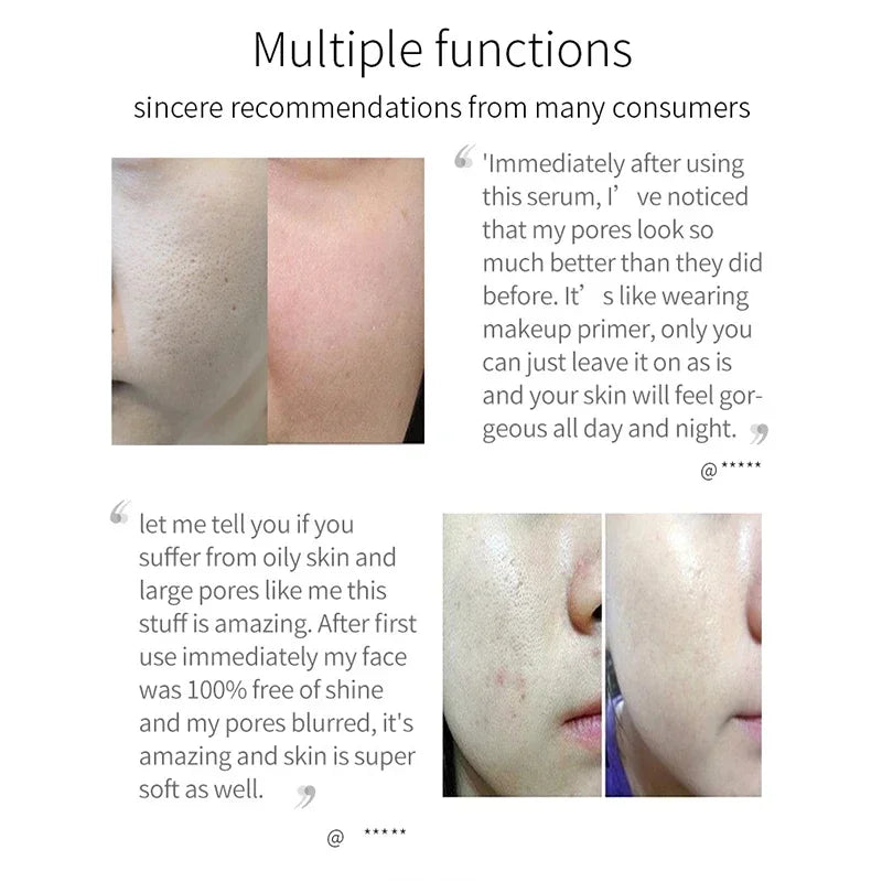Pore Minimizing Serum Face Tightening Skin Repair Treatment