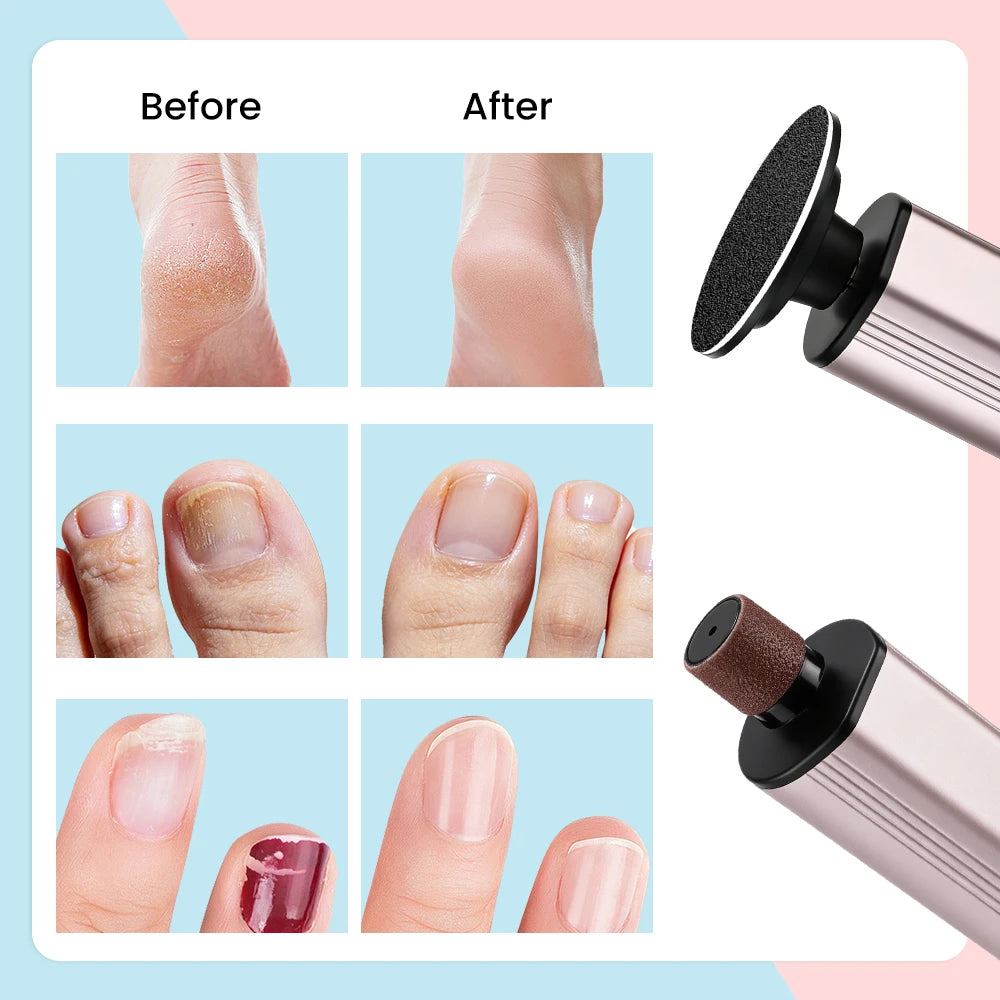 Electric Foot File Callus Remover Dual Direction Rechargeable Grinder - 6