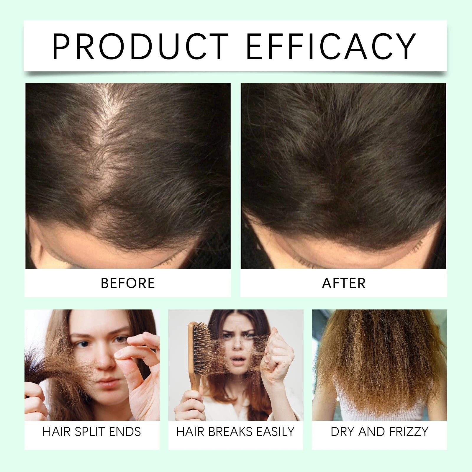 Rosemary Hair Growth Oil Scalp Treatment & Hair Loss Serum - 4