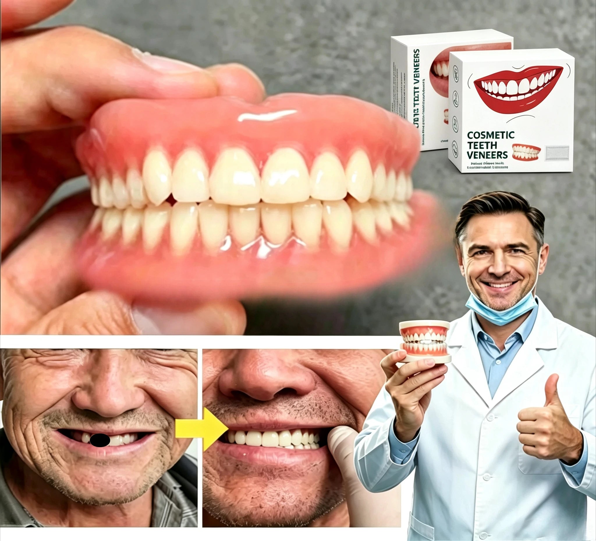 Flexible Resin Dentures Snap On Smile Teeth Restoration - 4