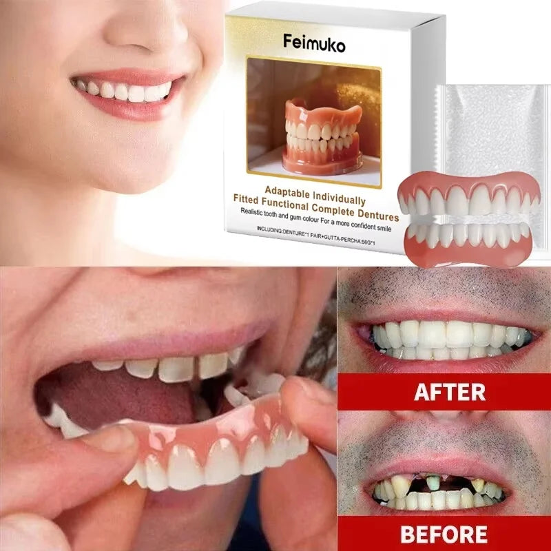 Denture Silicone Kit Soft Liners False Teeth Set - 2