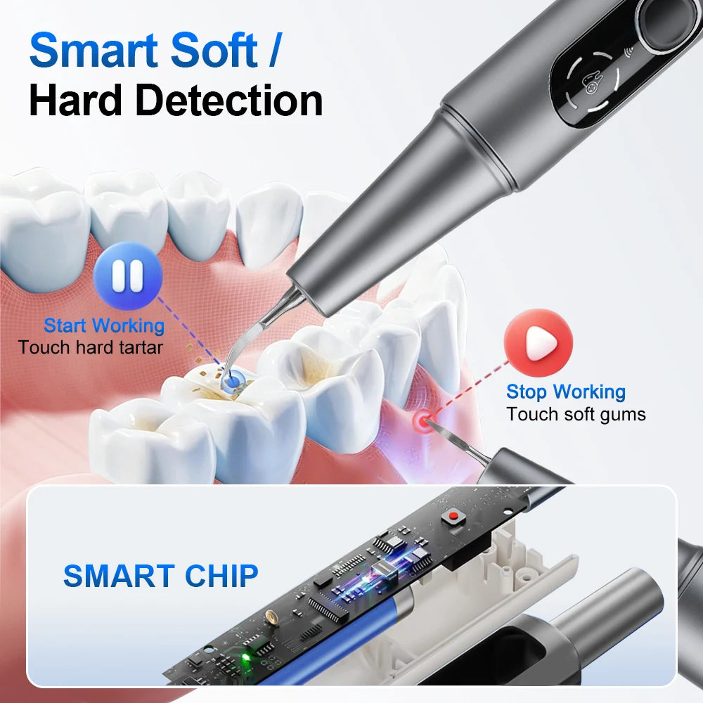 Visual Ultrasonic Dental Scaler HD Camera Tooth Cleaner Tartar Removal
