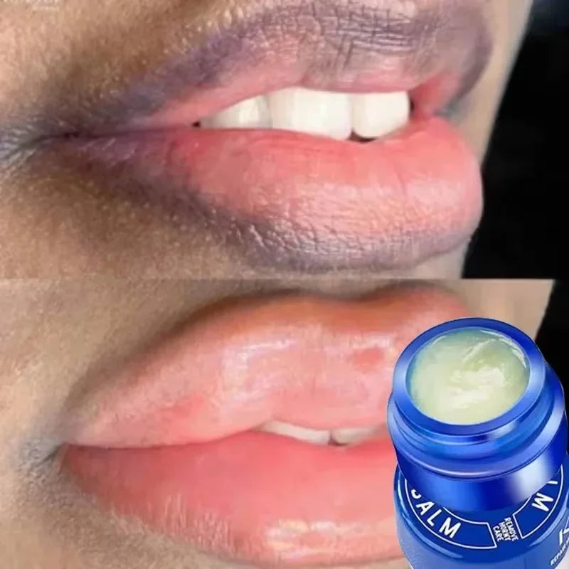 Dark Spot Lip Balm Lightening Mask and Exfoliating Lip Care Treatment - 1