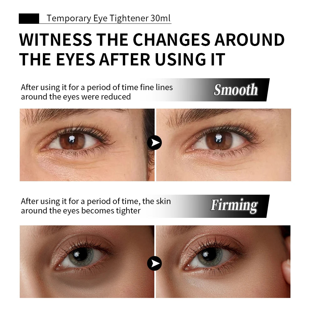 Temporary Eye Tightener Wrinkle Lifting Cream - 5