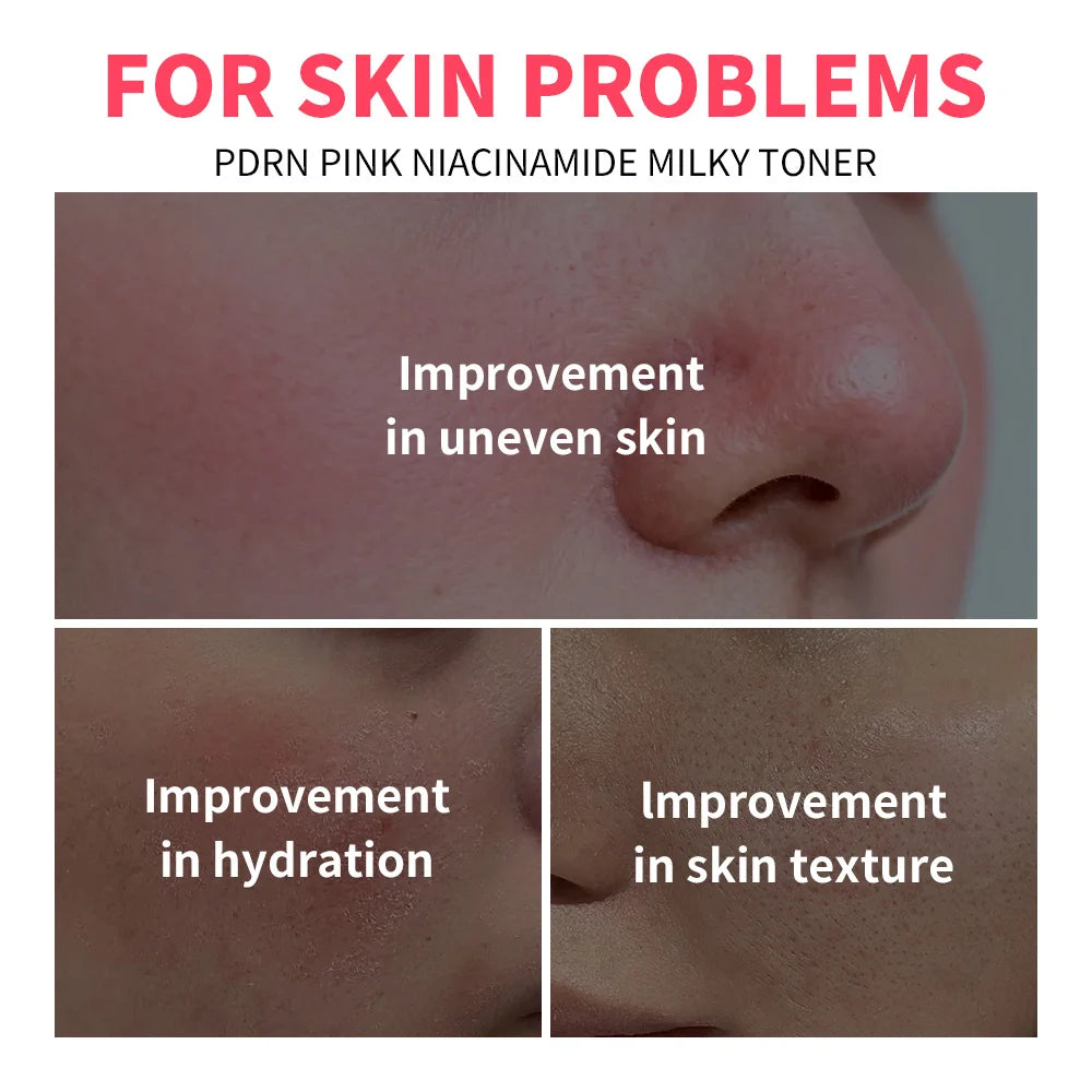 PDRN Pink Niacinamide Milky Toner Hydrating Facial Lotion - 6