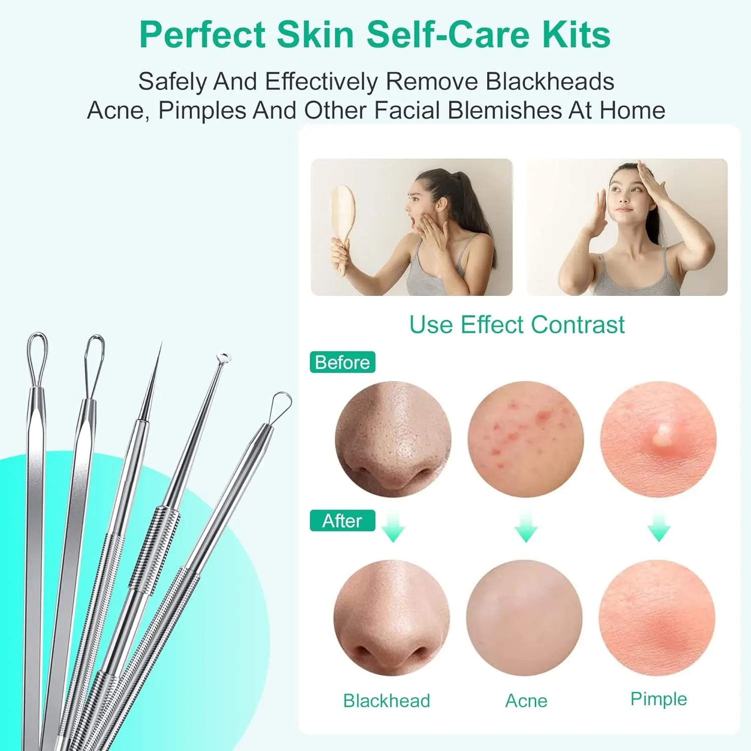 Stainless Steel Blackhead Remover Tool Kit Pimple Extractor - 4