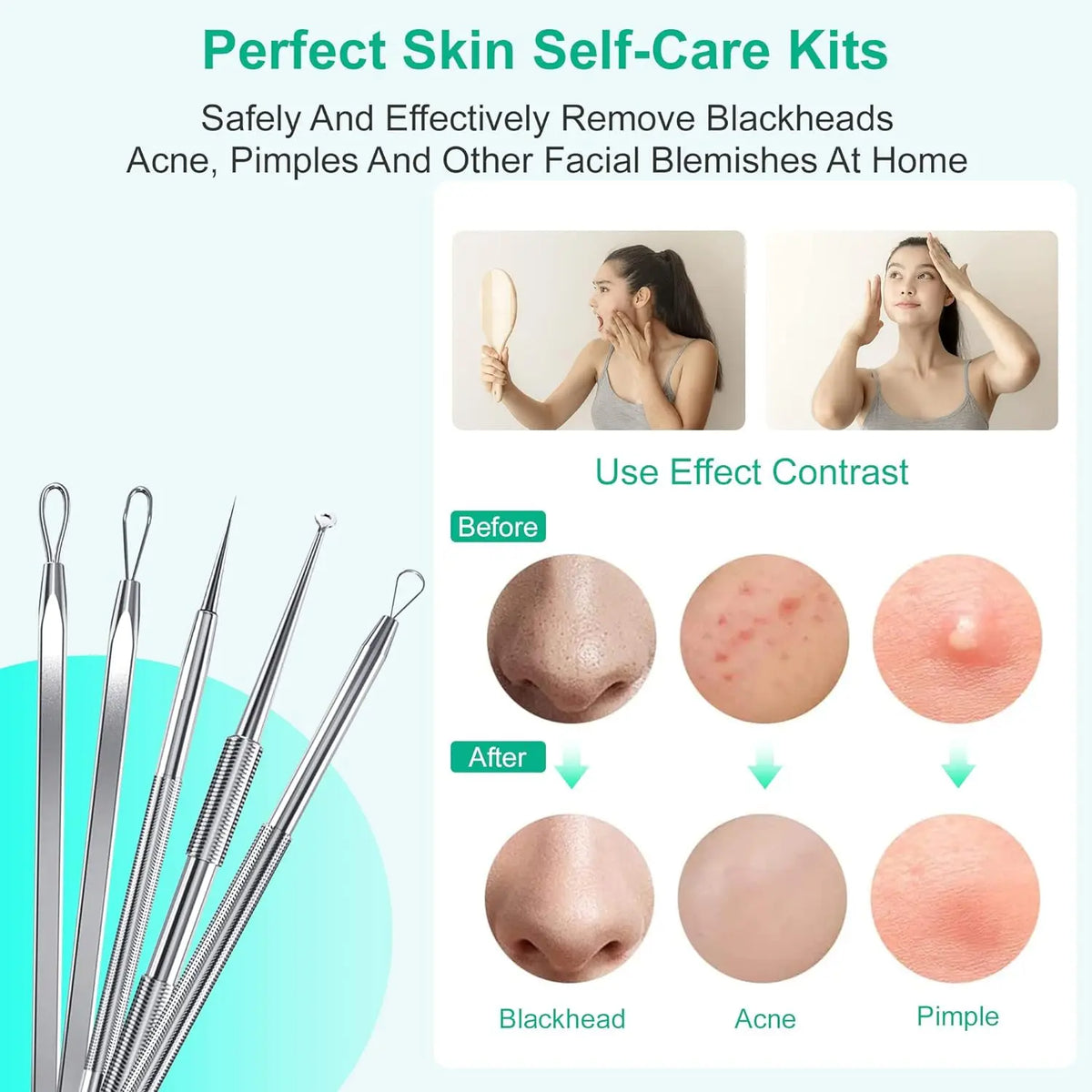 Stainless Steel Blackhead Remover Tool Kit Pimple Extractor