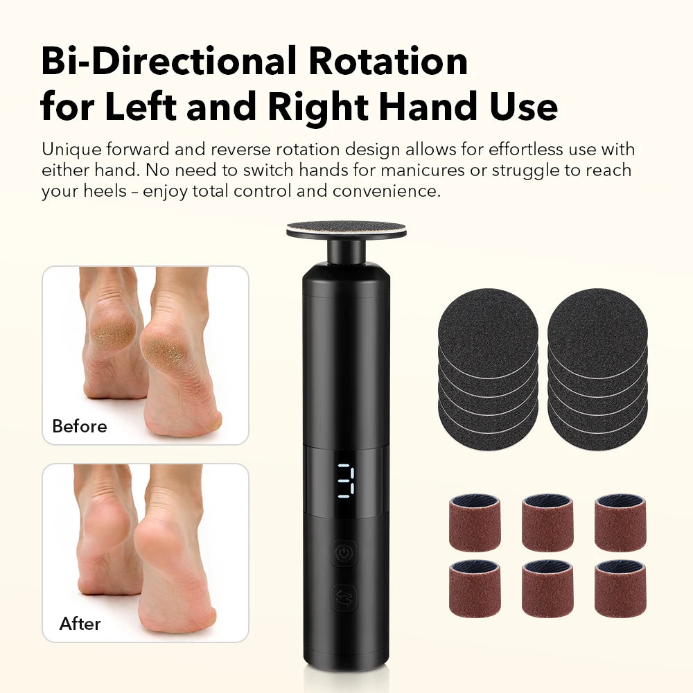 Electric Foot Callus Grinder Pedicure Tool Dead Skin Remover - 2