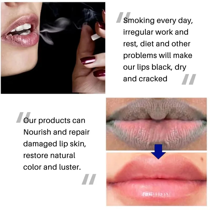 Dark Spot Lip Balm Lightening Mask and Exfoliating Lip Care Treatment - 6