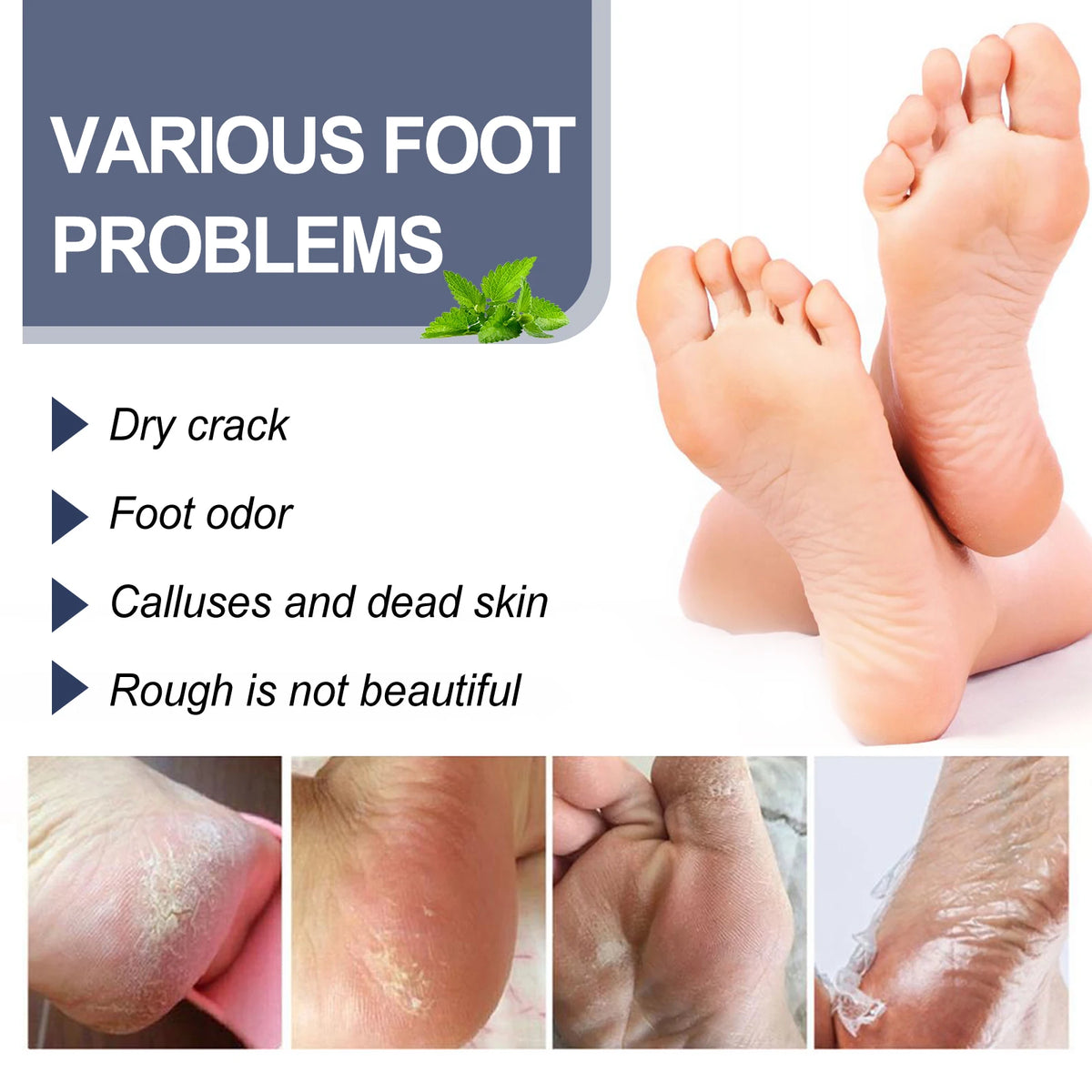 Ximonth Foot Deodorant Spray Odor Removal & Care