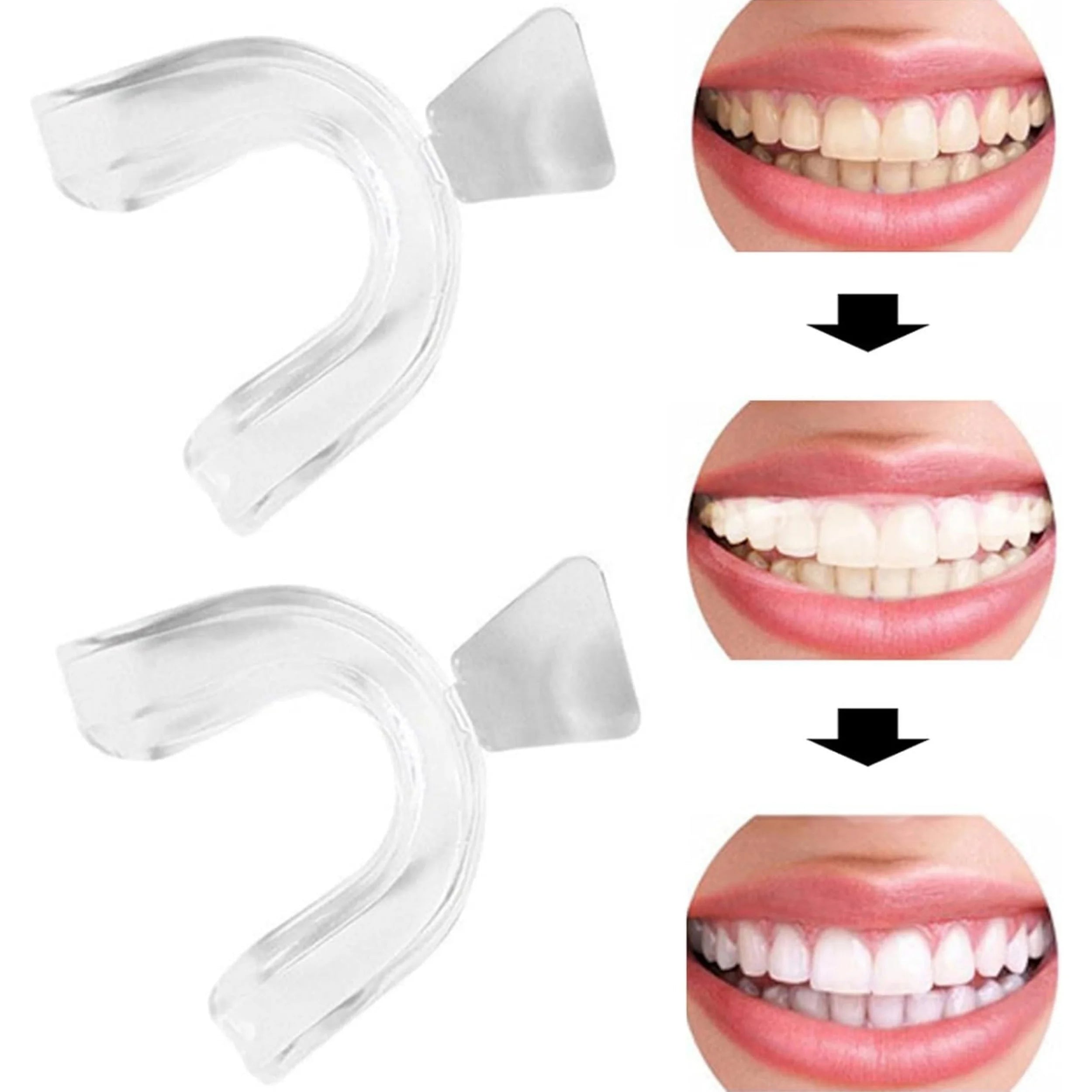 Silicone Mouth Guard Teeth Tray for Night Grinding and Teeth Whitening - 2
