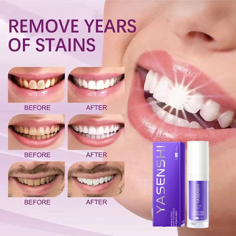 Whitening Toothpaste Fresh Teeth Oral Hygiene Deep Cleaning - 2