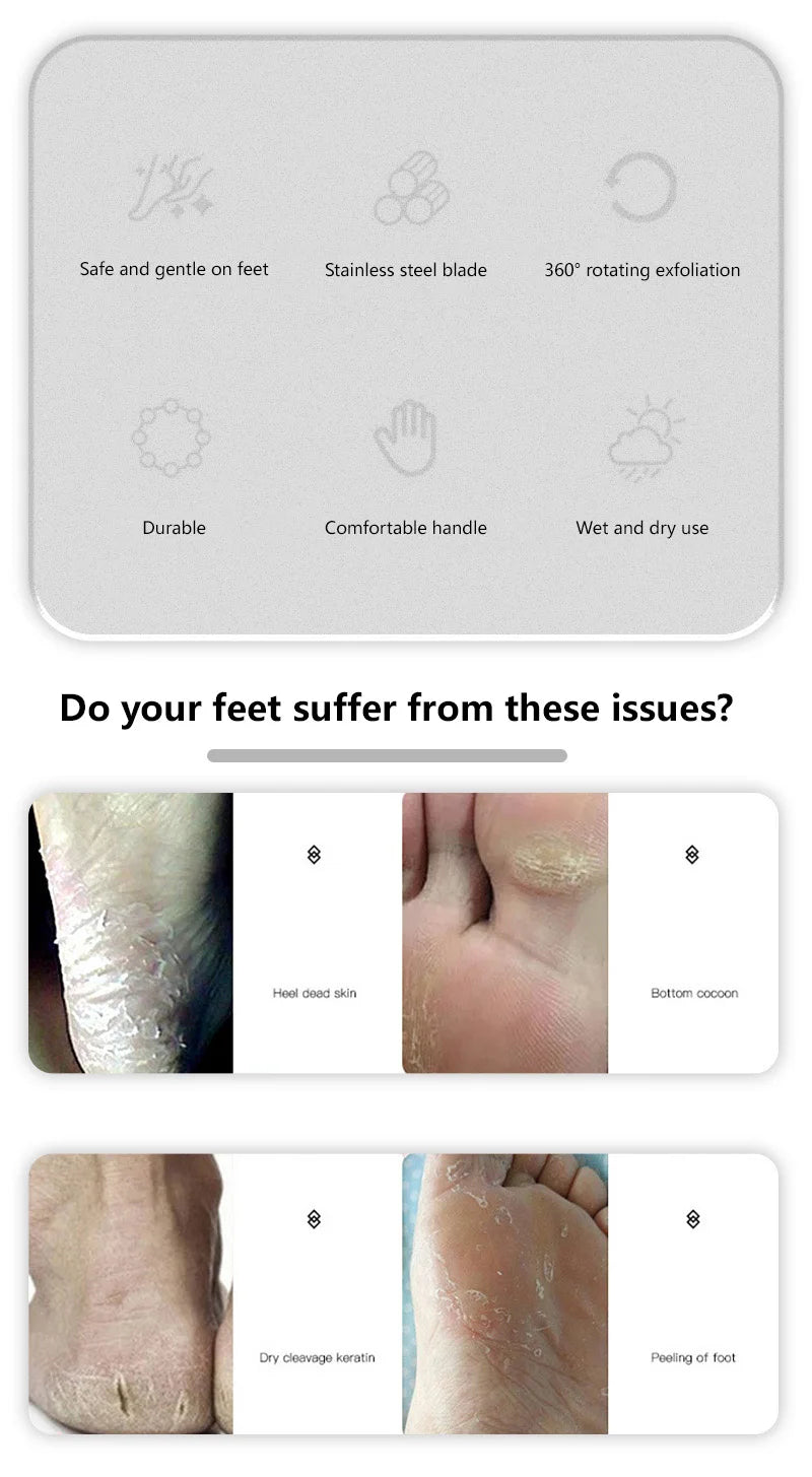 Professional Stainless Steel Foot File Cracked Heel Remover Pedicure Care