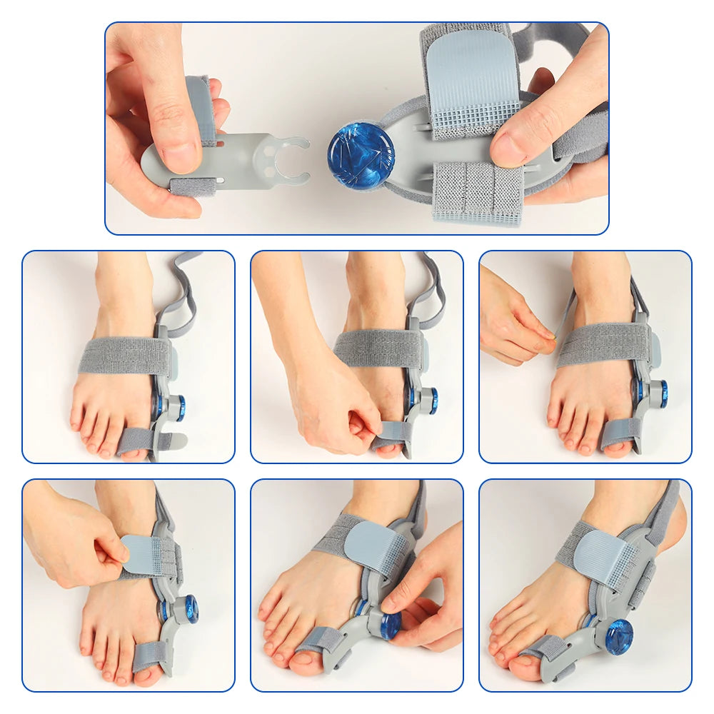 Adjustable Toe Straightener Bunion Corrector Splint - 6