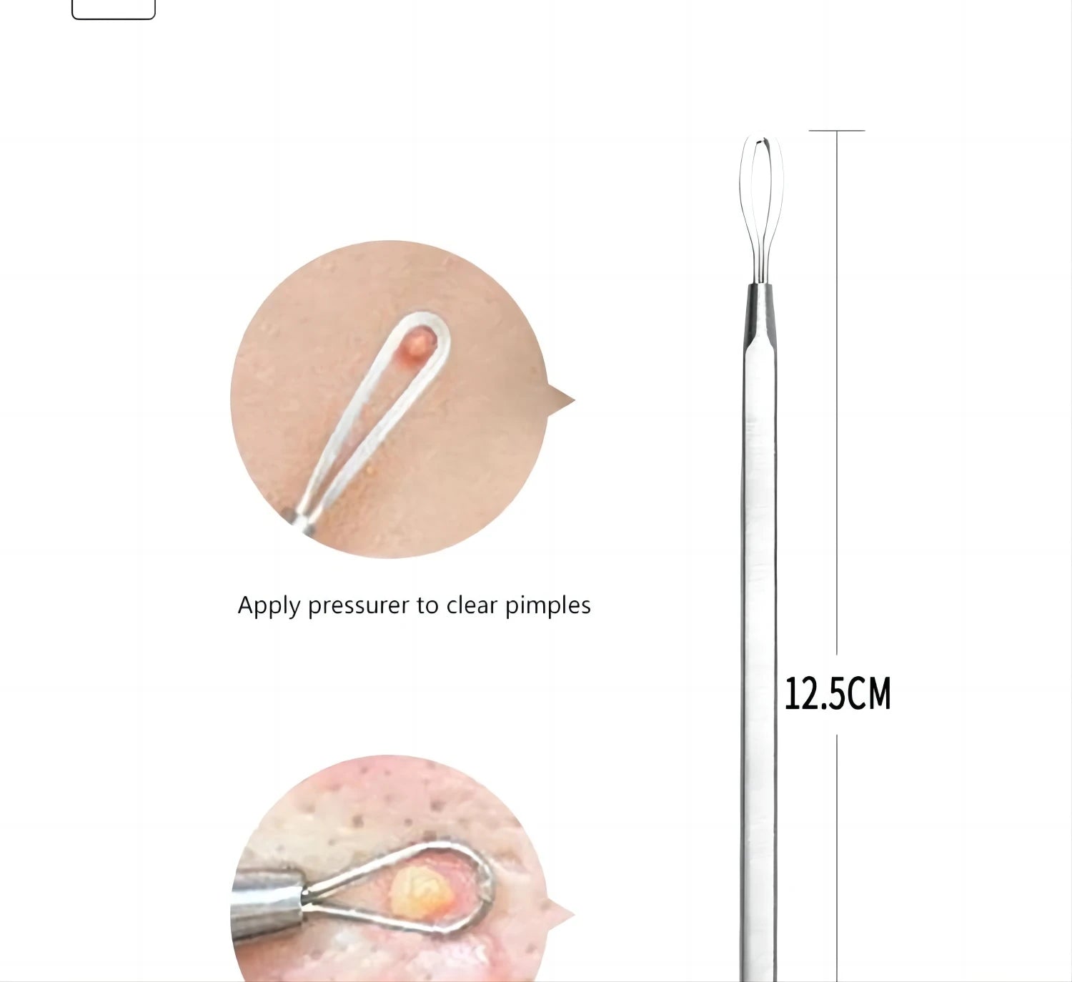 Stainless Steel Blackhead Remover Tool Kit Pimple Extractor - 13
