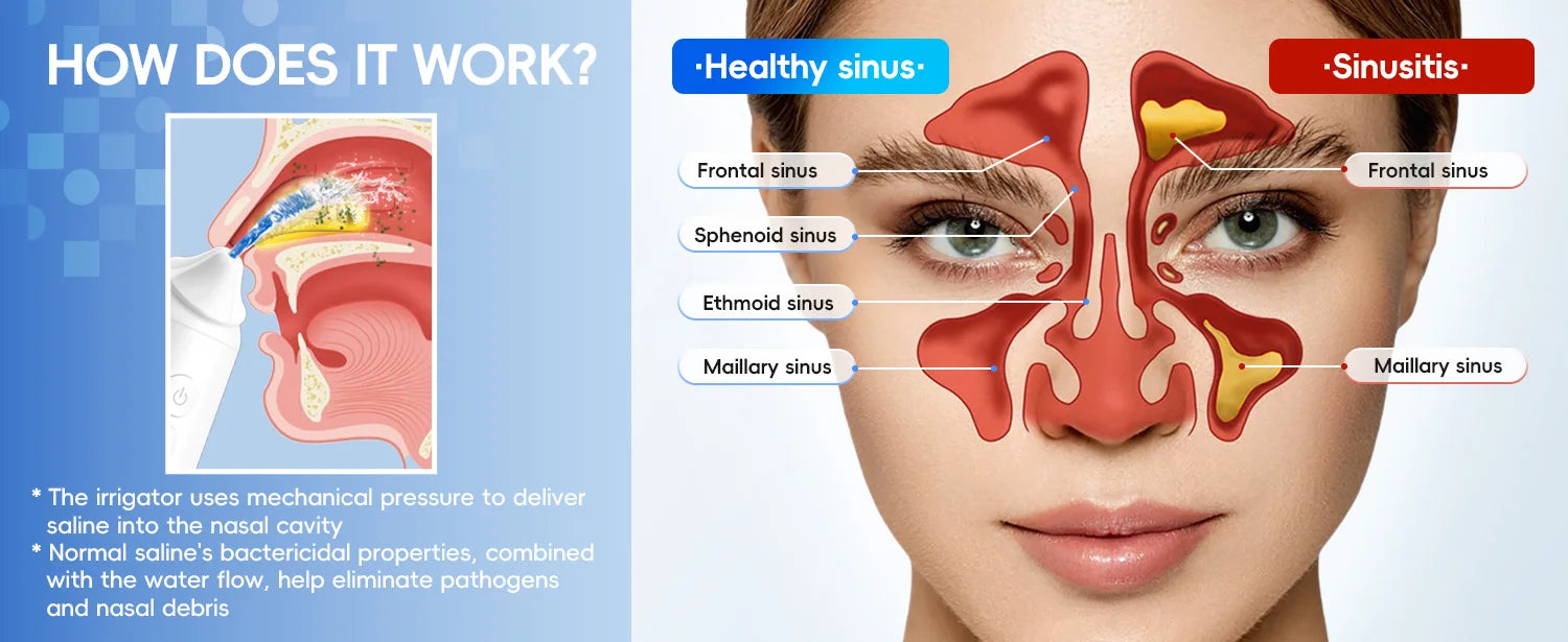Electric Nasal Irrigator Sinus Rinse Machine - 9