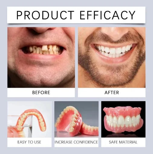 Silicone Dentures Full Mouth Fake Teeth Veneers
