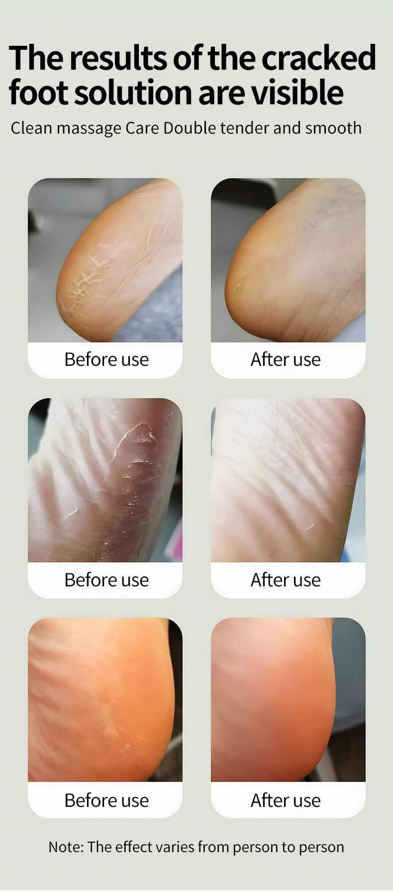 Electric Foot Callus Remover Dead Skin Pedicure Tool