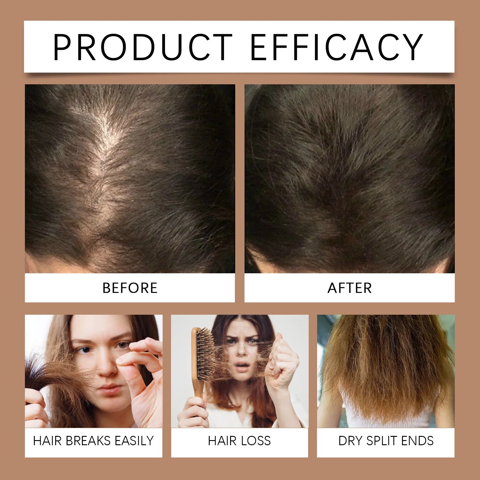 Hair Growth Shampoo Anti Dandruff Nourishing Repair Scalp Care - 10