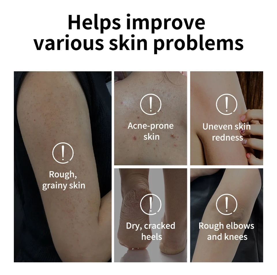 Glycolic Acid Exfoliating Body Stick Moisturizing Scrub Lotion