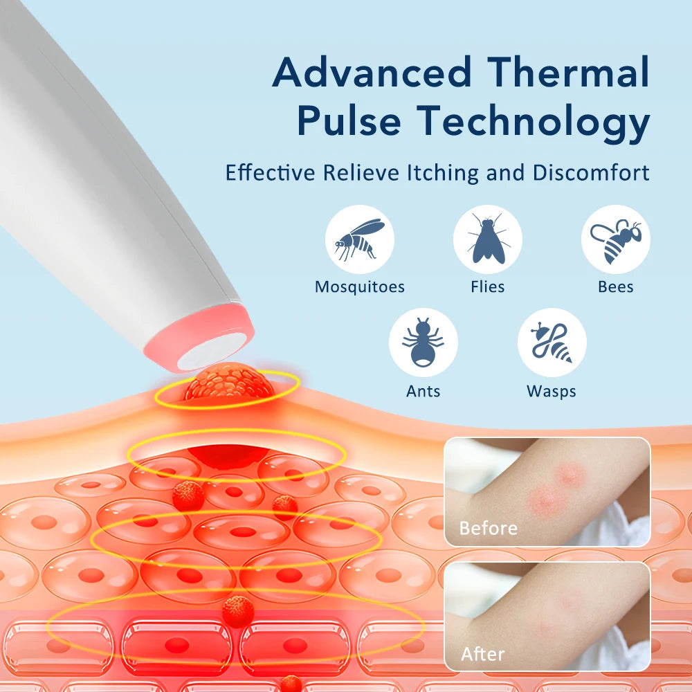 Anti Itch Pen Mosquito Bite Relief Tool