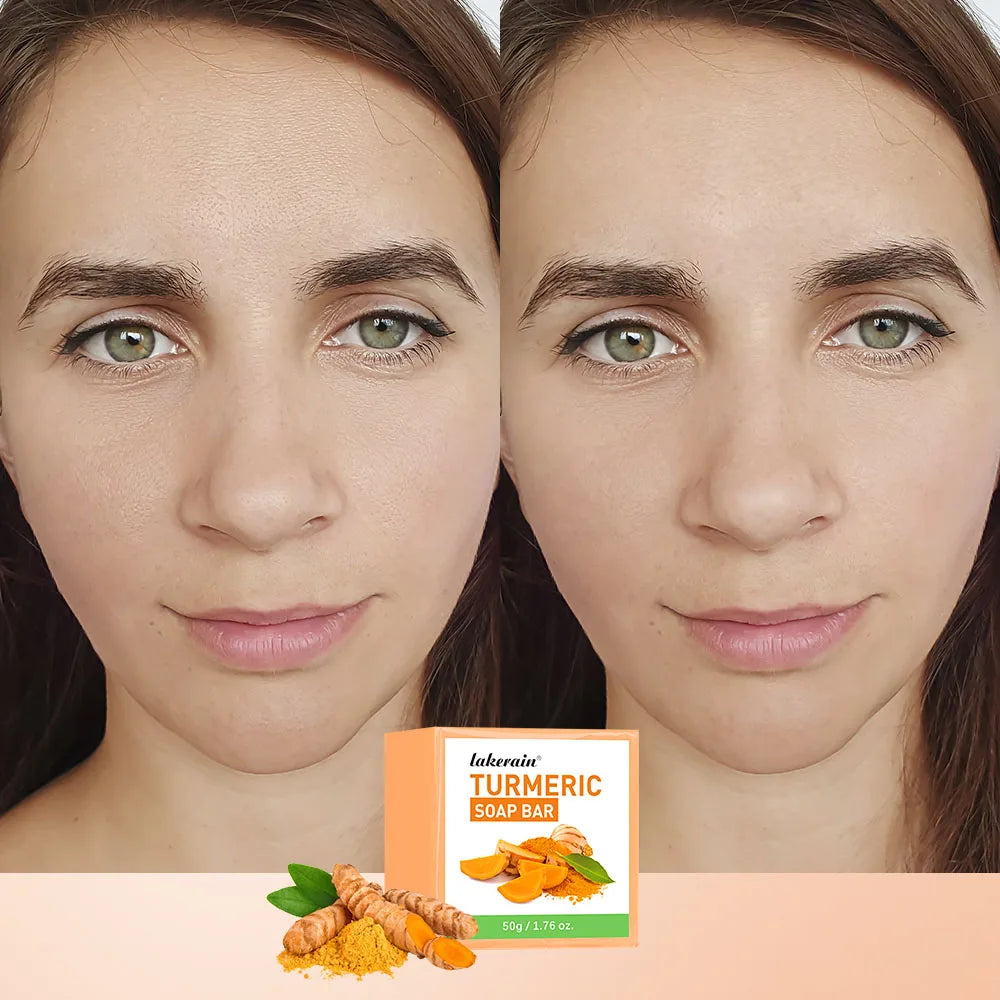 Turmeric Lemon Kojic Acid Soap Natural Skincare Bar - 3