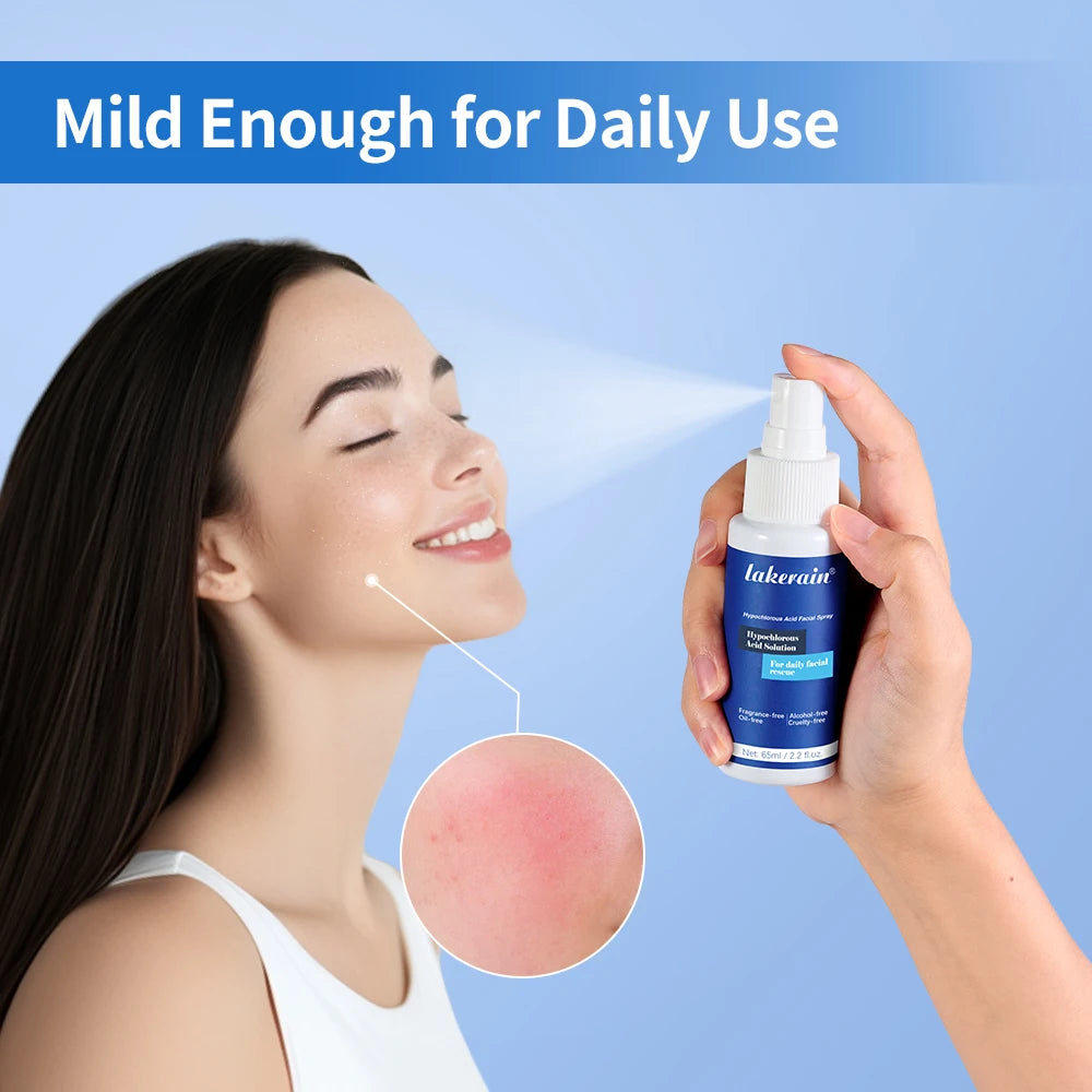 Hypochlorous Acid Facial Spray Redness Acne Post Workout Cleanser